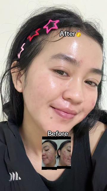 @Ce owi🐜🇮🇩🇹🇼