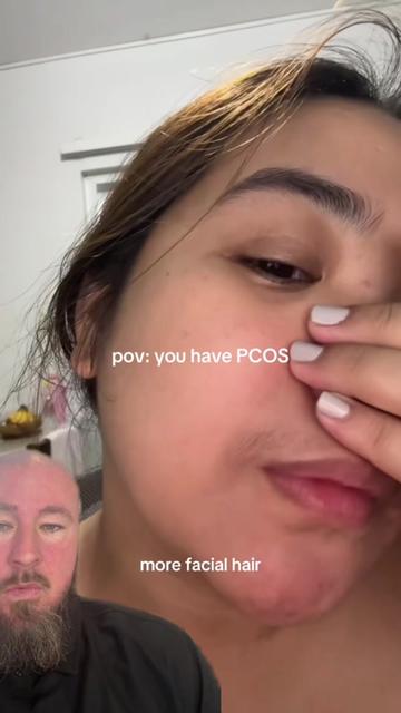 @Drew Baird | the PCOS mentor