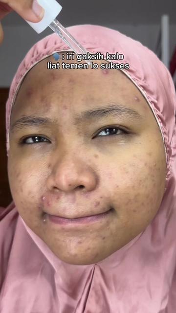 @MBAK CUNGCAT BAYI
