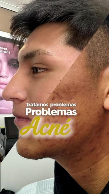 @RebellSpa