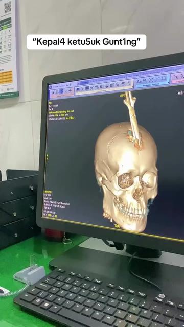 @Sobat Radiology