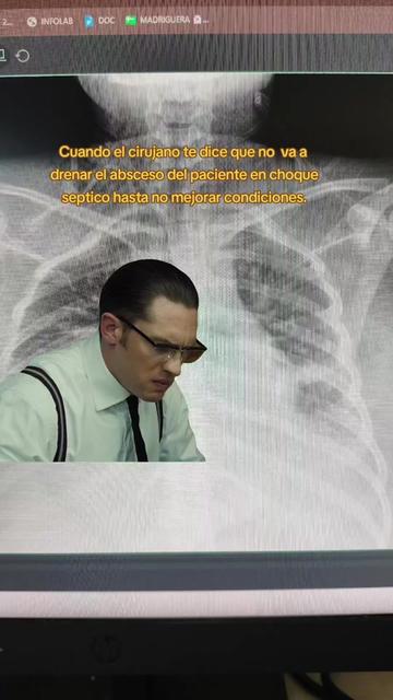 @Dr. Ajolote.
