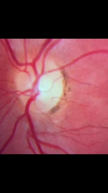 @Maria Coward Eye Doctor