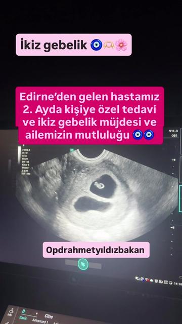 @opdrahmetyildizbakan