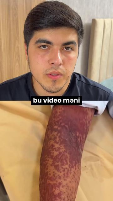 @📽️ Azər Əhmədov