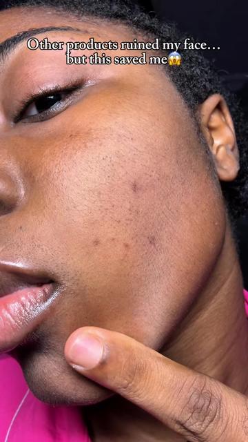 @Mimi | Beauty | Skincare