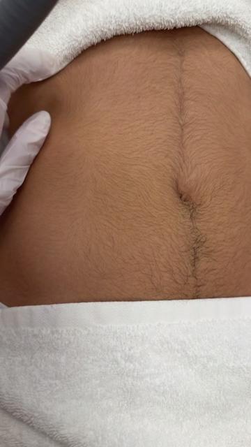 @Fatma Laser Düsseldorf