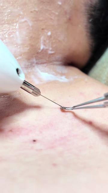 @MONA SKIN LASER & BEAUTY