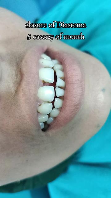 @Dr.Sumit Mandal Dental Surgeon