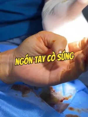 @Chuy&ecirc;n gia xương khớp