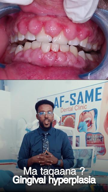 @Dr. Maano 🦷