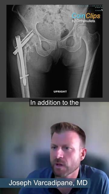 @Orthobullets