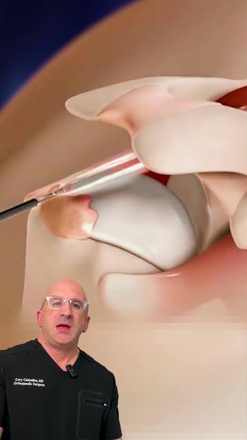 @Bone Doctor - Joint Pain MD