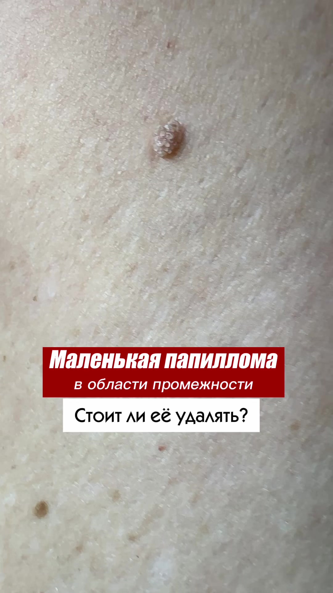 @Гинеколог Москва