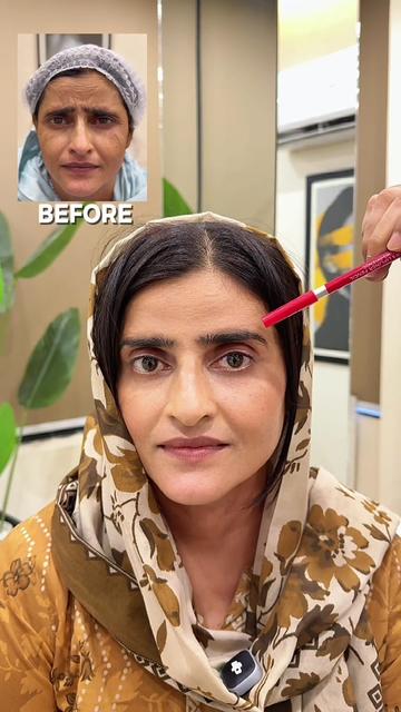 @MR Aesthetics 📞 0325 9611110