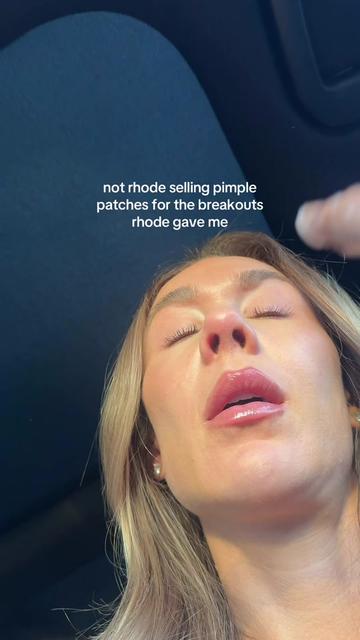 @Celeste | RN acne expert