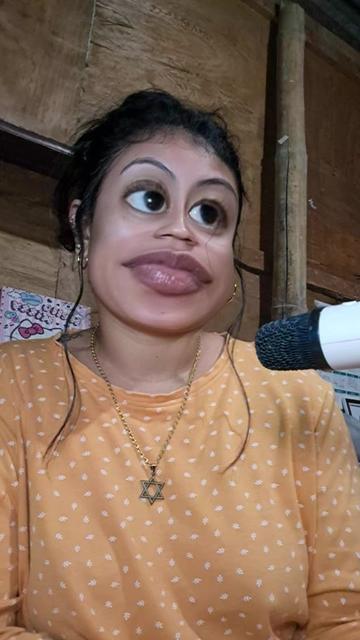 @Alison Medina