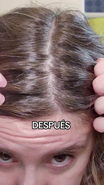 @Puli✨️Dermocosmiatra rebelde