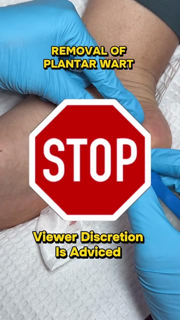 @Deniel Foot and Ankle Center