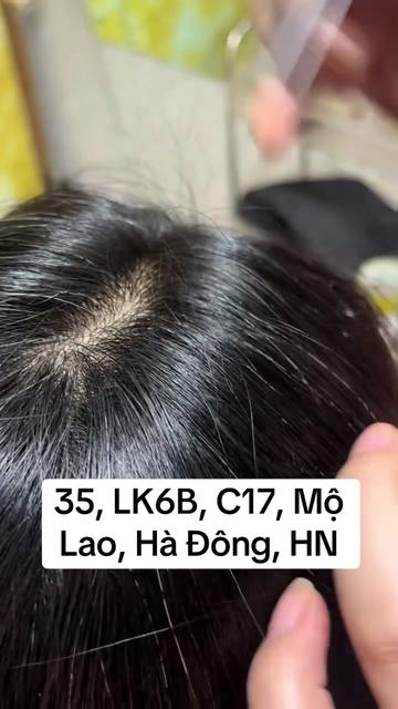 @Nhổ tóc bạc Hà Đông