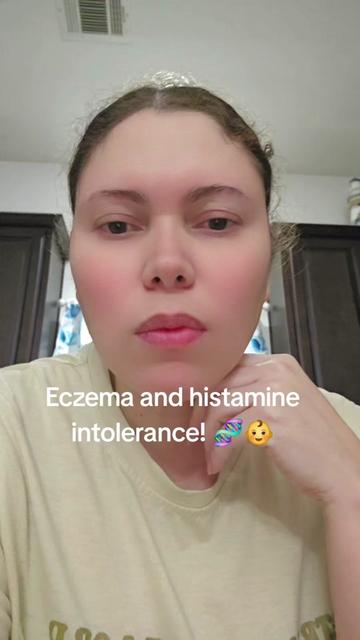 @Ariel|Ezcema•SAHM🩷