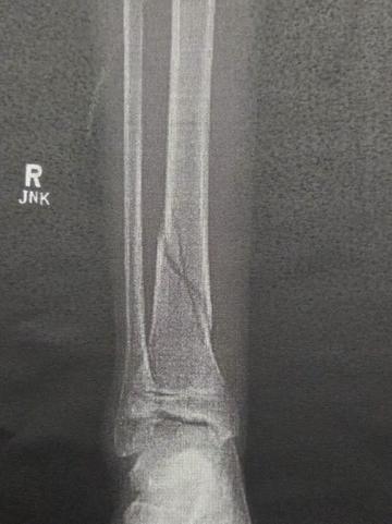 @🍉