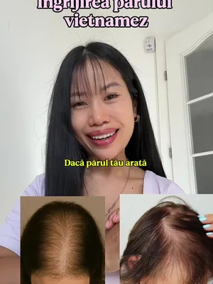 @Lily Official