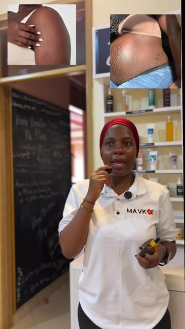 @MAVK SKINCARE SUPPLIERS UG