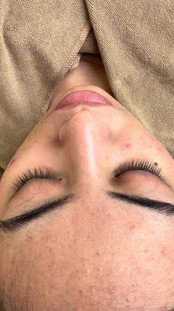 @MONA SKIN LASER & BEAUTY