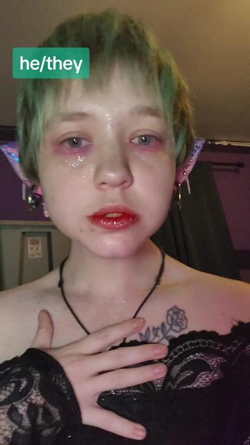 @♿️♾️DisabledFairyBoy✨️💫