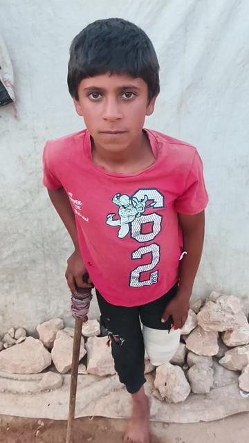 @Ali the amputee🇵🇸😭🥹