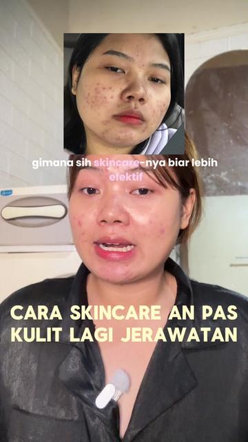 @ichi | glow up journey