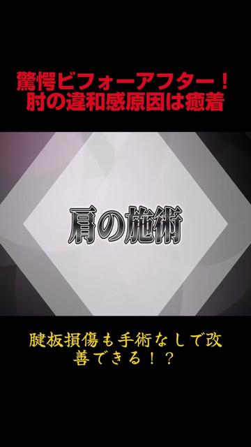 @Yoinno-yoin