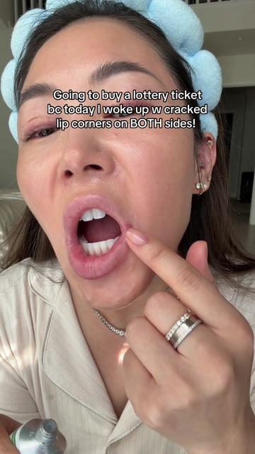 @Joycethedentist OC Veneers