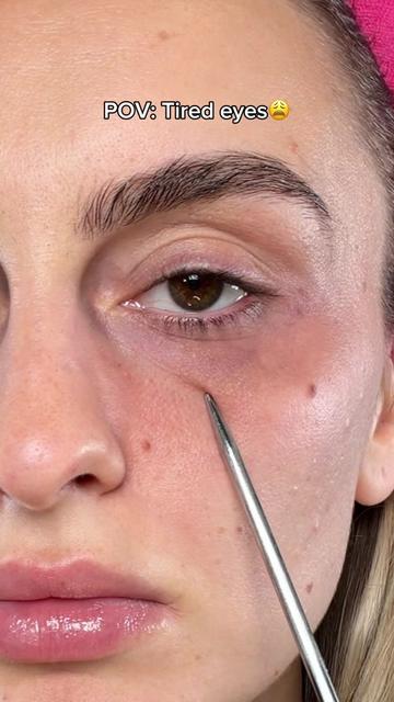 @Loresa