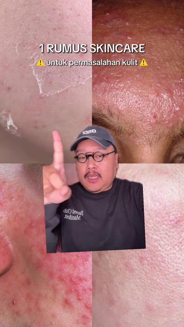 @Ali | @HungryForSkincare