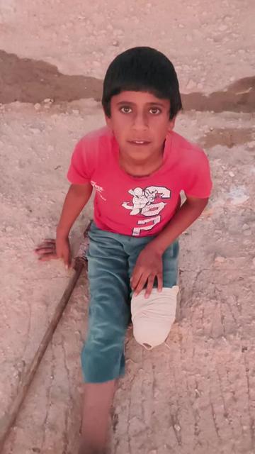 @Ali the amputee🇵🇸😭🥹