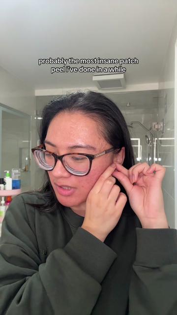 @jennilee • thatacnegirlie