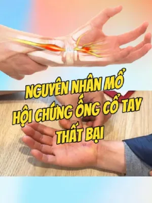 @Chuyên gia xương khớp