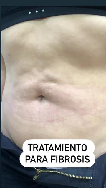 @kamelialosada