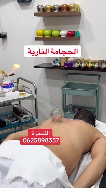 @Hijama.abdelmajid
