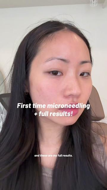 @Lily Tran