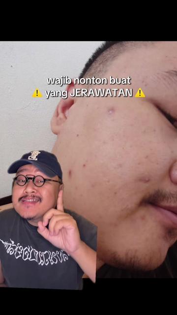 @Ali | @HungryForSkincare