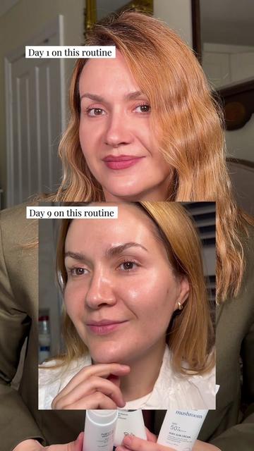 @Marina @4complexion