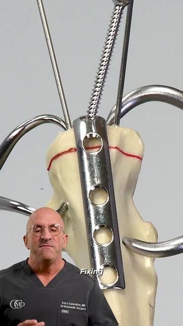 @Bone Doctor - Joint Pain MD