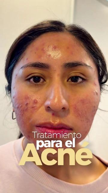 @RebellSpa