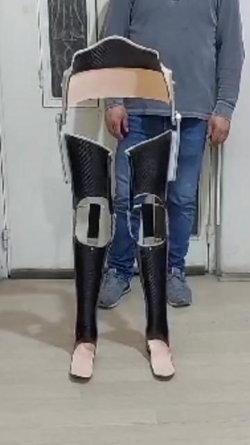 @KanatOrtopedi
