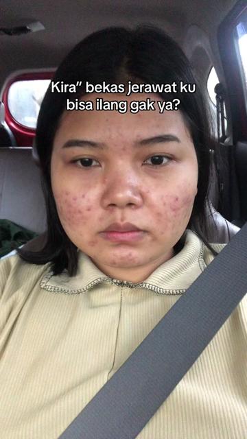 @ichi | glow up journey