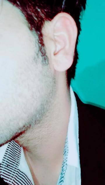 @Manish Aswal ✔