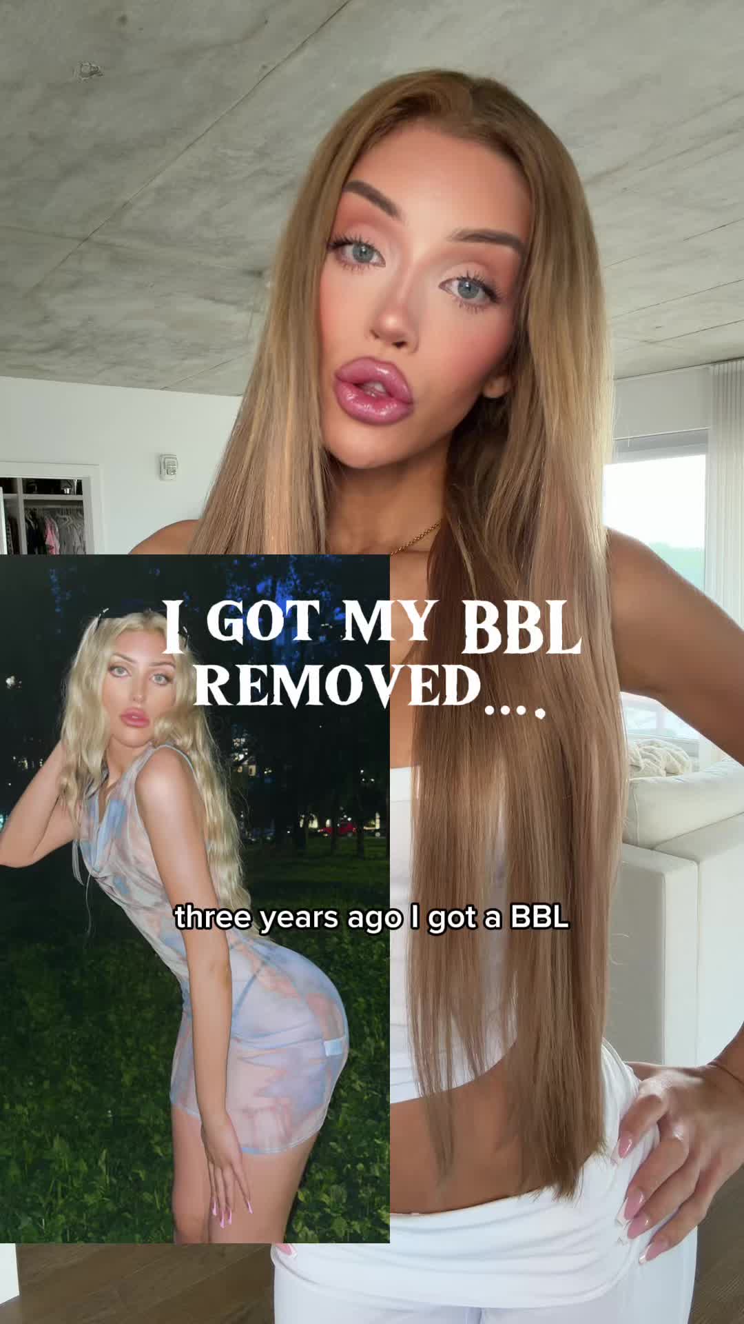 @Adea